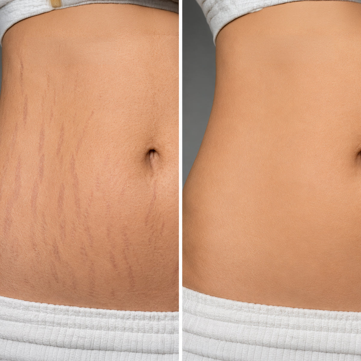 Before and after skincare result